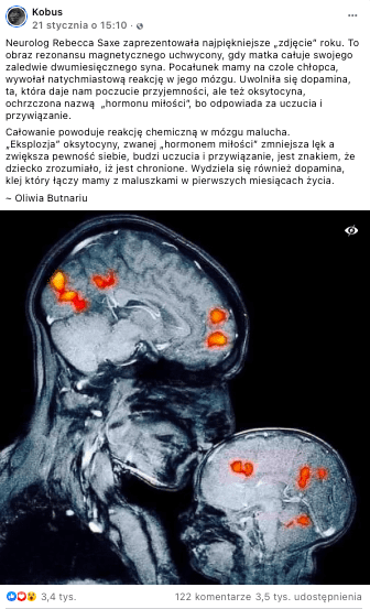 Analizowany post na Facebooku. Zdjęcie MRI matki z dzieckiem, na głowach pomarańczowe plamki.