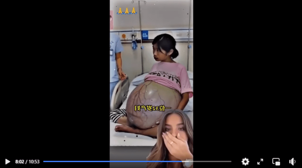 Zrzut ekranu z nagrania na Facebooku, na którym widać kobietę cierpiącą na przypadłość wywołaną nowotworem.