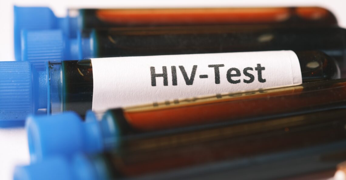 HIV ma ukryć uszkodzenie odporności po szczepieniu? Fałsz!