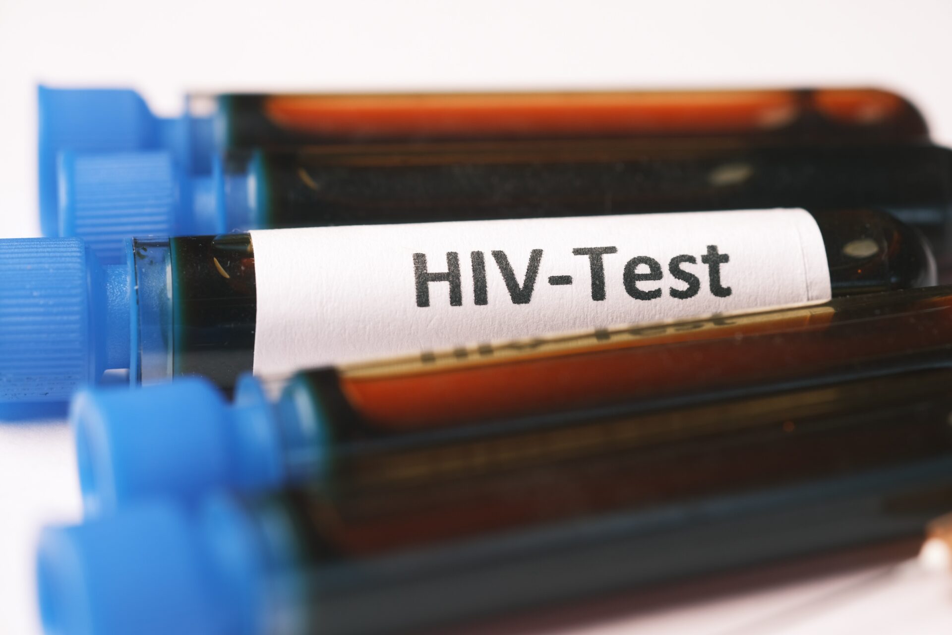 HIV ma ukryć uszkodzenie odporności po szczepieniu? Fałsz!