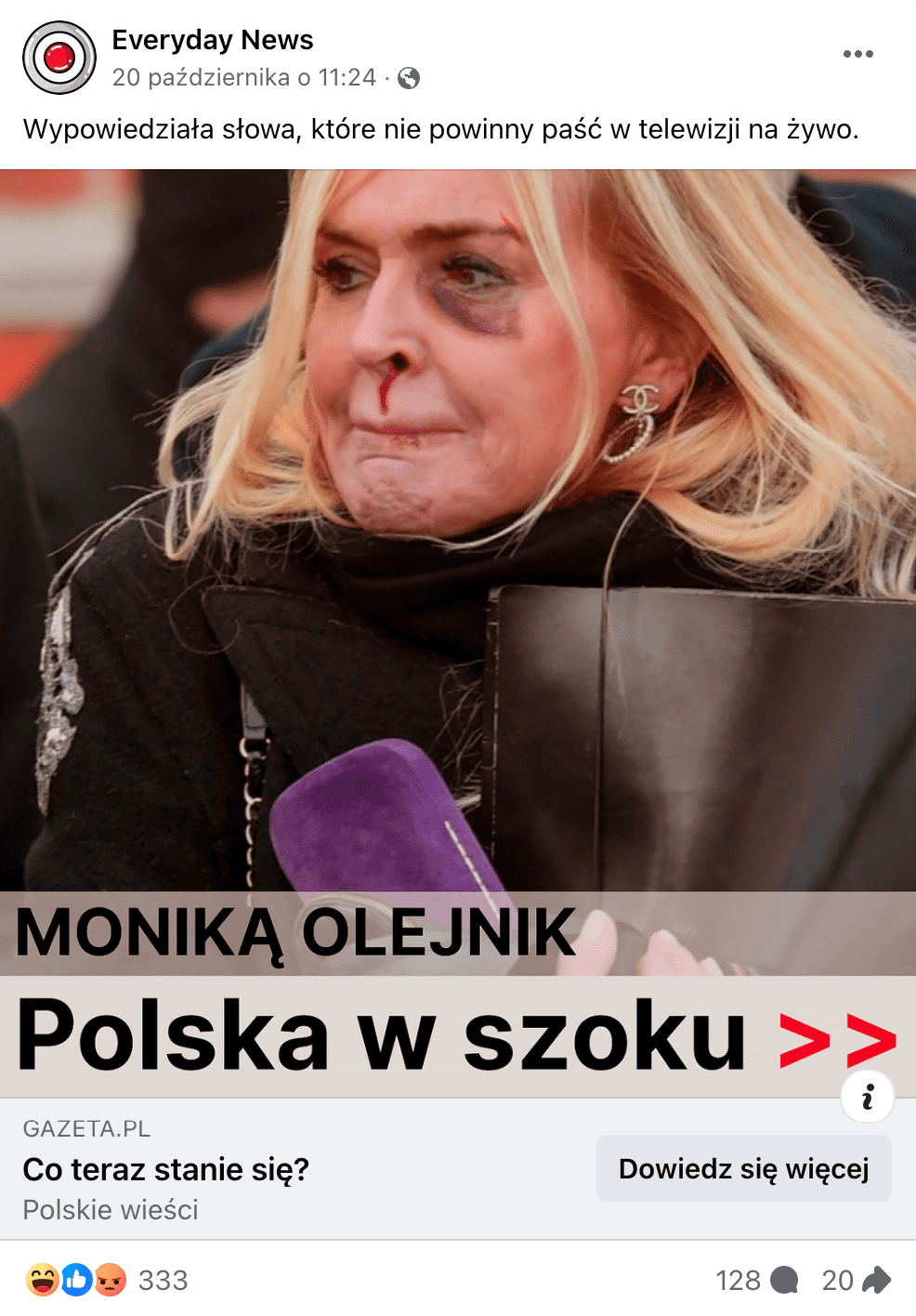 Zrzut ekranu jednego z omawianych postów. Widoczna jest Monika Olejnik z ranami na twarzy.