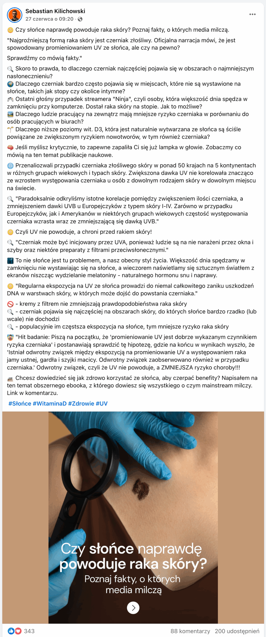 Zrzut ekranu posta na Facebooku. Dołączono do niego zdjęcie: to zbliżenie na znamię na dekolcie kobiety w brązowej bluzce. Obok znajdują się dłonie w niebieskich rękawiczkach ochronnych osoby badającej znamię. W jednej ręce trzyma lupę. Na zdjęciu umieszczono napis: „Czy słońce naprawdę powoduje raka skóry? Poznaj fakty, o których media milczą”. 343 reakcji, 88 komentarzy, 200 udostępnień.